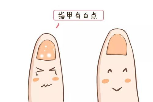 最新91视频网站品牌告诉你指甲上有白点是缺哪种微量元素